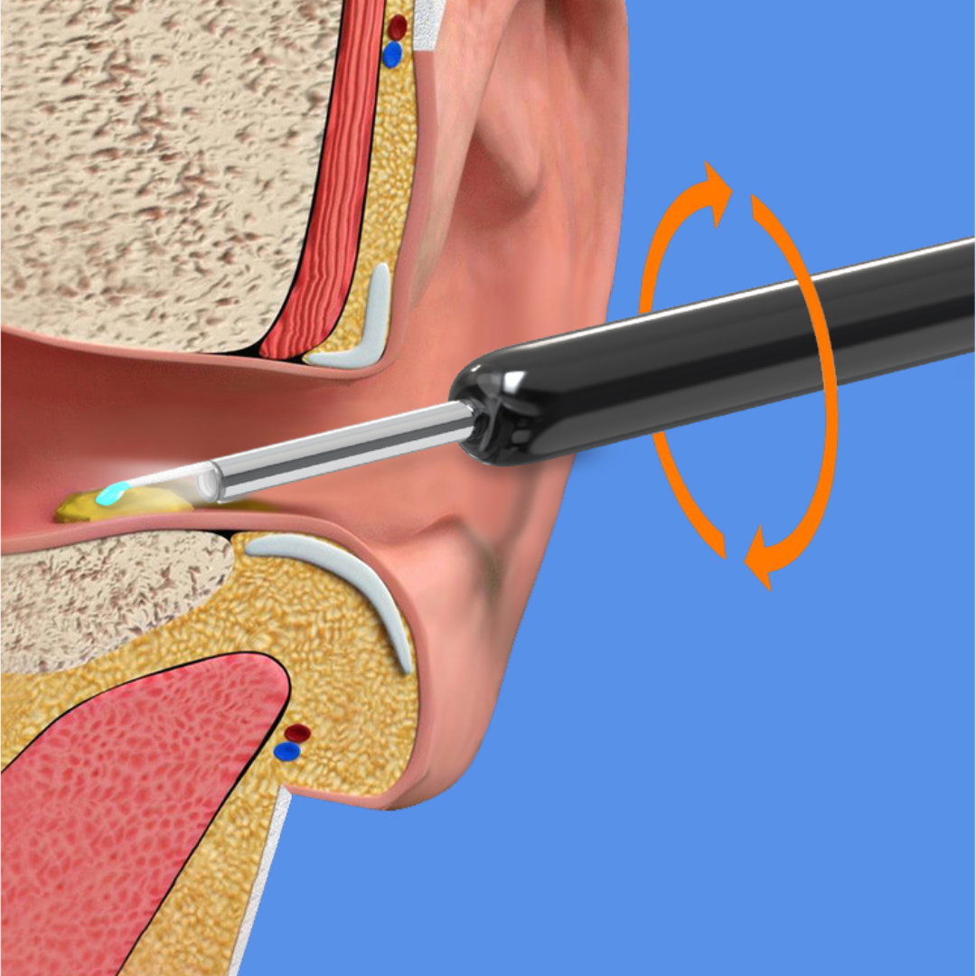 iScope™ Pro Max (+ 1 Kit Ustensiles OFFERT)